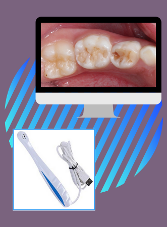 Intraoral Camera