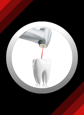 Laser Dentistry