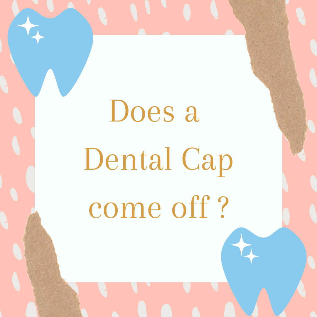 Does A Dental Cap Come Off ?