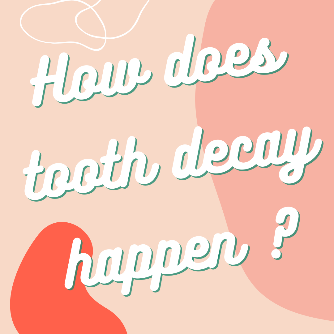 How Does Tooth Decay Happen?