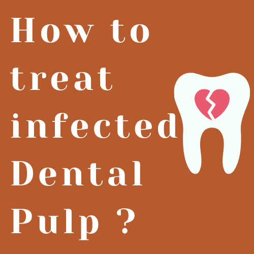 How to treat an infected dental pulp?