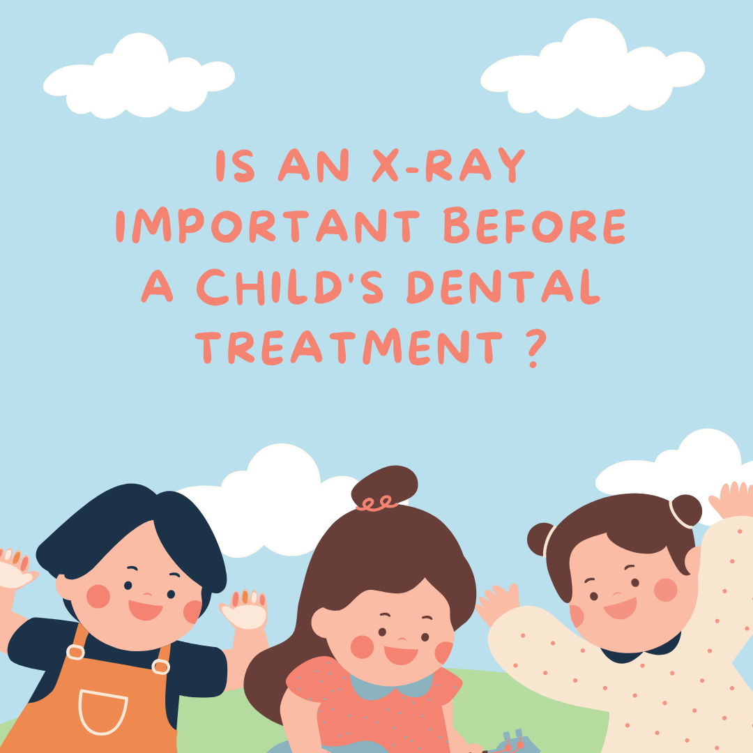 Is an X-Ray important before a child's dental treatment?