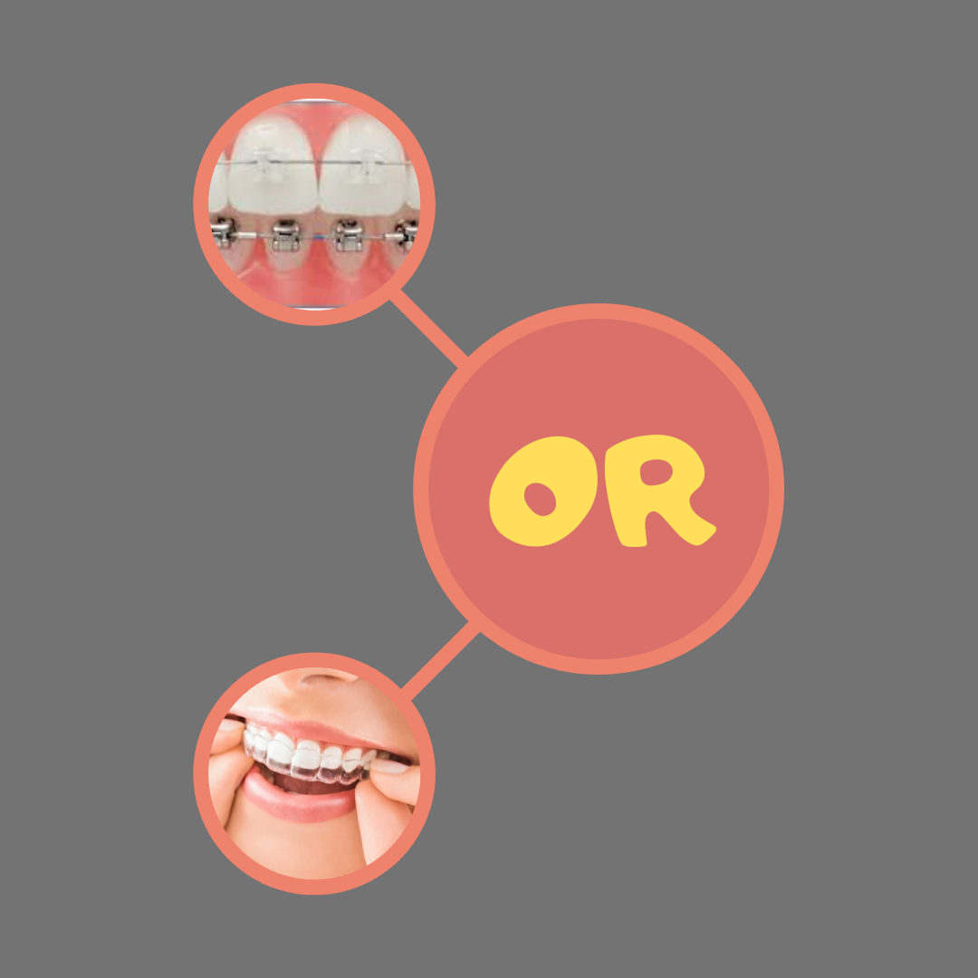 Types of Braces 